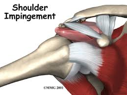 Chiropractor shoulderpain